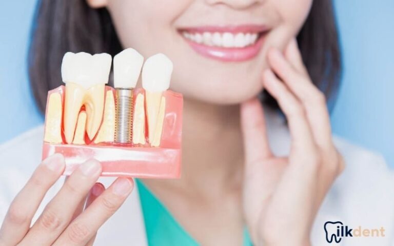 Bayrampaşa İmplant Diş ile Sağlıklı Gülüşler