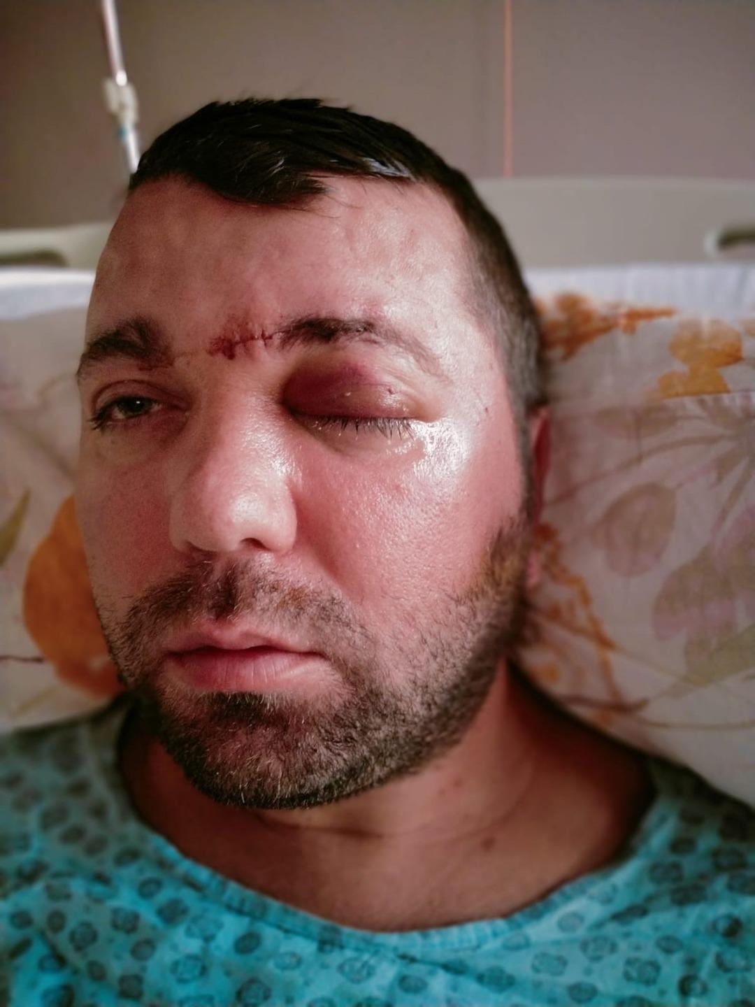 Bursa'da inanılmaz olay: Dişçiye gitti, hayatı kabusa döndü! Neredeyse ölüyordu 3